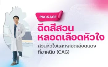 ฉีดสีสวนหลอดเลือดหัวใจ (CAG)