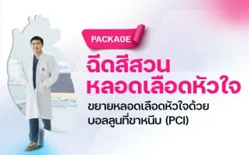 ฉีดสีสวนหลอดเลือดหัวใจ (PCI)